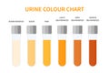 Urine color chart illustration of dehydration level