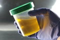 Urine drug testing Royalty Free Stock Photo