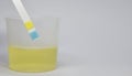 Urine examination strip Royalty Free Stock Photo