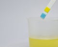 Urine examination strip Royalty Free Stock Photo
