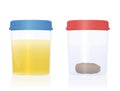 Urine Sample Fecal Specimen Stool Sample Cup Medical Examination