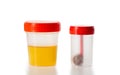 Urine and feces analysis on a white background, isolate. Examination of urine and feces for infections, close-up Royalty Free Stock Photo