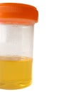 Urine sample Royalty Free Stock Photo