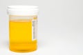 Urine Sample