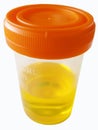 Urine sample Royalty Free Stock Photo