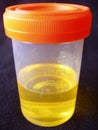 Urine sample