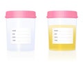 Urine Sample Gynecology Specimen Cup Empty Blank Label Royalty Free Stock Photo