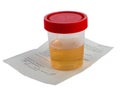 Urine Sample Royalty Free Stock Photo