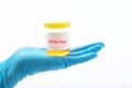 Urine sample for STDs test Royalty Free Stock Photo