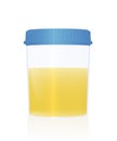 Urine Sample Specimen Cup Medical Examination Urological Checkup Royalty Free Stock Photo