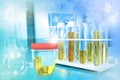 Test-tubes in modern medical study clinic - urine quality test for ph or amorphous phosphates, medical 3D illustration