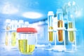 Test tubes in modern bio research facility - urine quality test for doping or calcium carbonate, medical 3D illustration