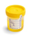 Urine Sample