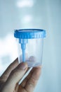 Urine sample test cup Royalty Free Stock Photo
