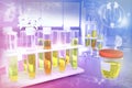 Urine sample test for leukocyte esterase or diabetes - test tubes in modern medical university facility, medical 3D illustration