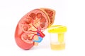 Urine sample with test strips and kidney