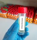 Urine Sample for Urinary Electrolytes test with laboratory background. Closeup.