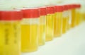 Urine samples Royalty Free Stock Photo