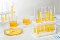 Urine samples in laboratory glassware on table. Urology concept Royalty Free Stock Photo