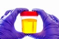 Urine specimen: medical analysis. Urine analysis in the laboratory.