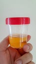 Urine specimen plastic box and hand Royalty Free Stock Photo