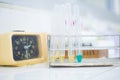 Urine specimen for Urine examination Royalty Free Stock Photo