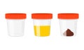 Urine and stool samples, empty and full plastic cups. Urinalysis, poo analysis set. Laboratory examination concept Royalty Free Stock Photo