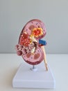 Urolithiasis and human a kidney anatomy closeup