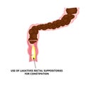 Use of laxatives rectal suppositories for constipation. Feces in colon. Infographics. Vector illustration on isolated