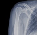 Used shoulder x-ray