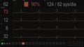 User Interface of medical software for ECG tests