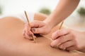 Using acupuncture to reduce cellulite