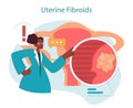 Uterine fibroids. Doctor illustrates uterine fibroids condition, zooming