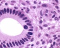 Uterine gland