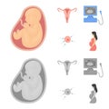 Uterus, apparatus of ultrasound, fertilization. Pregnancy set collection icons in cartoon,monochrome style vector symbol