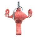 Uterus disease concept. Human uterus as hand grenade. 3D rendering