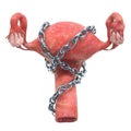 Uterus disease concept. Human uterus with chain. 3D rendering