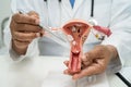 Uterus, doctor with anatomy model for study diagnosis and treatment in hospital
