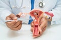 Uterus, doctor with anatomy model for study diagnosis and treatment in hospital