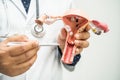 Uterus, doctor holding anatomy model for study diagnosis and treatment in hospital