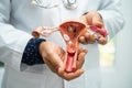 Uterus, doctor holding anatomy model for study diagnosis and treatment in hospital