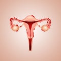 Uterus with endometriosis