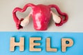 Uterus with Help word. Anatomical model of human uterus is on grey background, below letters that make word Help on blue backgroun