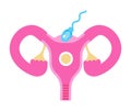 Uterus icon vector. Internal woman organ. World menopause day, endometriosis illustration. Human spermatozoid is running, Royalty Free Stock Photo