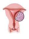 Uterus - Menstrual Pain Royalty Free Stock Photo