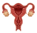 Uterus And Ovaries Royalty Free Stock Photo