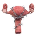 Uterus Pain concept. Human uterus with barbed wire. 3D rendering