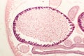 Uterus of parasitic nematode worm Royalty Free Stock Photo