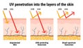 UV penetration into the layers of the skin. Infographic of sunscreen protection against UVA, UVB rays. Skin anatomy. Broad-