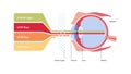 Uv rays and visible light healthcare infographic. Vector flat illustration. UVA, UVB, UVC lights go through ozone layer to eye